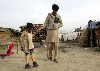 Con siete años, Asmaa Bibi, quien perdió las piernas hace tres cruzando una línea de ferrocaril mientras pasaba un tren, camina con unas piernas ortopédicas junto a su padre en Islamabad (Pakistán), el 12 de marzo de 2017.