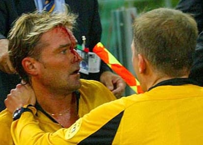 El árbitro sueco Frisk, con el rostro ensangrentado tras la agresión.