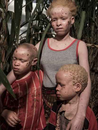 Moamina, de seis años (derecha), y sus dos hermanas mayores, Sienna, de 16 (centro), y Suema, de nueve (izquierda), junto a su casa de un barrio de Lichinga. Las tres niñas padecen albinismo. Viven con su madre y sus dos hermanos. Su padre los abandonó hace años.