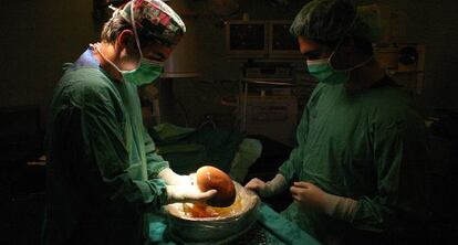 Miembros de la unidad de trasplantes del hospital sevillano Virgen del Rocío.