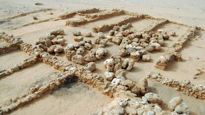 Zona de anclaje.