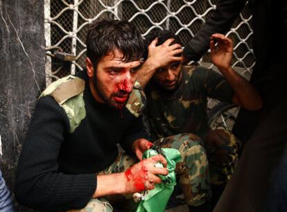Miembros de las fuerzas de seguridad heridos en las protestas.