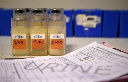 Muestras de orina en un laboratorio de Chatenay-Malabry, Francia.