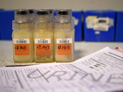 Muestras de orina en un laboratorio de Chatenay-Malabry, Francia.