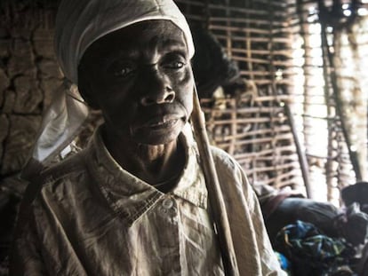 Jetou Mapuani perdió la vista a causa de la oncocercosis y su marido la abandonó.