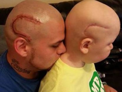 Muere Gabriel Marshall, el niño cuyo padre se tatuó una cicatriz como la suya en la cabeza