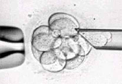 Manipulación en laboratorio de un embrión humano.