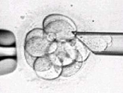 Manipulación en laboratorio de un embrión humano.