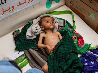 El hambre acecha Afganistán