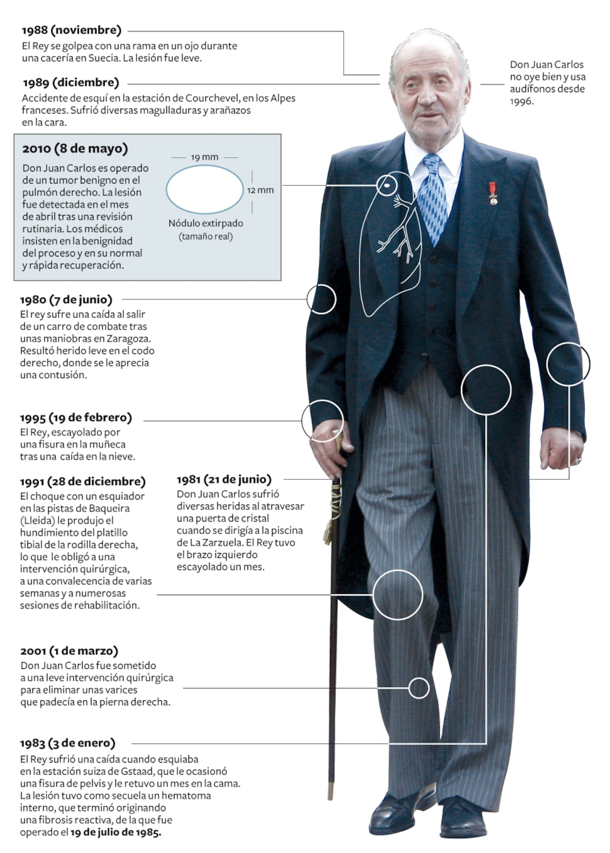 Las operaciones del Rey | Media | EL PAÍS