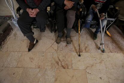 Los pacientes proceden de zonas controladas por la oposición. En la imagen, tres hombres con extremidades amputadas esperan a ser atendidos, en la ciudad Maaret al-Numan el 20 de marzo de 2016.