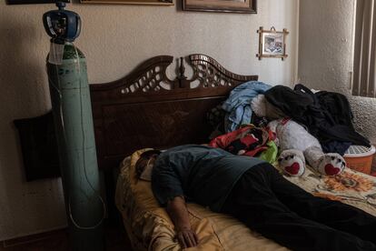 Miguel Martínez, muestra la forma en que debe dormir al usar el oxígeno que le proporcionó el hospital. Miguel permanece con un daño del 50% en sus pulmones y debe usar oxigeno por tres meses más.