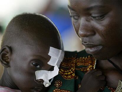 Niño africano desnutrido con sonda, junto a su madre