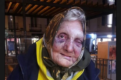 Anciana agredida en el distrito de Centro de Madrid.