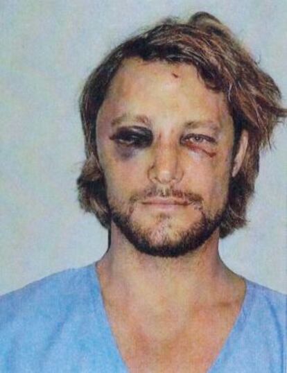 Gabriel Aubry, después de la pelea con Olivier Martínez.