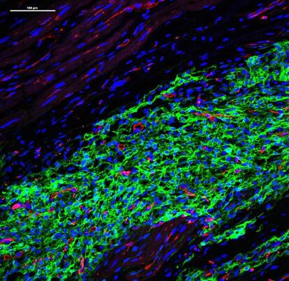 El implante de células humanas (en verde) contiene una red estructurada de vasos sanguíneos derivados del huésped macaco (en rojo).