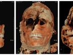 Una tomografía axial computarizada de una de las momias de Pompeya.