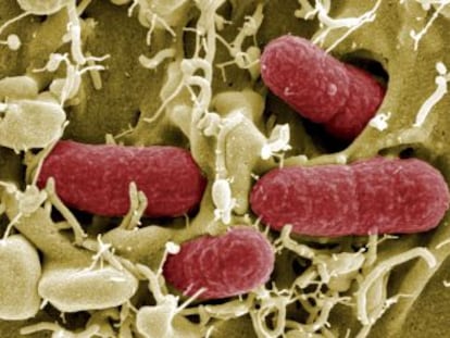 Un análisis de los fallecidos por bacterias resistentes a los antibióticos sugiere que cada año podrían morir 35.000 personas por esa causa en España