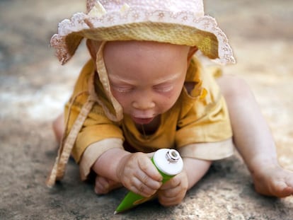 Una niña albina en Tanzania.