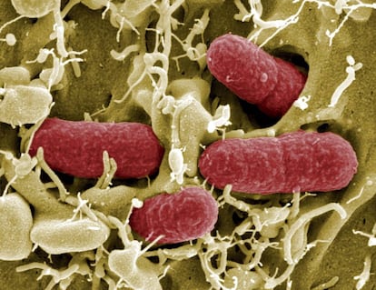 La bacteria E. Coli es una de las que presentan más resistencias