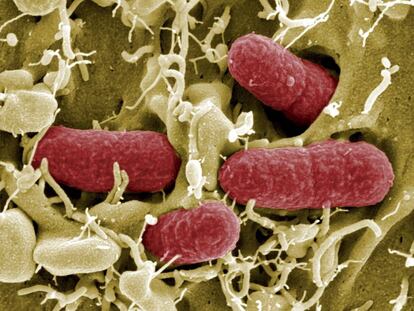 La bacteria E. Coli es una de las que presentan más resistencias