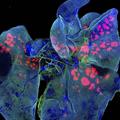 Pulmones de un ratón, llenos de micropartículas, que aparecen en la imagen en coloreadas en rojo y rosa. Un tinte fluorescente permitió a los científicos visualizar las micropartículas incluso una semana después de administrar el medicamento que las contenía. Este tipo de imágenes sirven para investigar nuevas formas de administrar fármacos solo en partes concretas del cuerpo y evitar así los efectos secundarios tóxicos que provocan algunos tratamientos contra el cáncer.