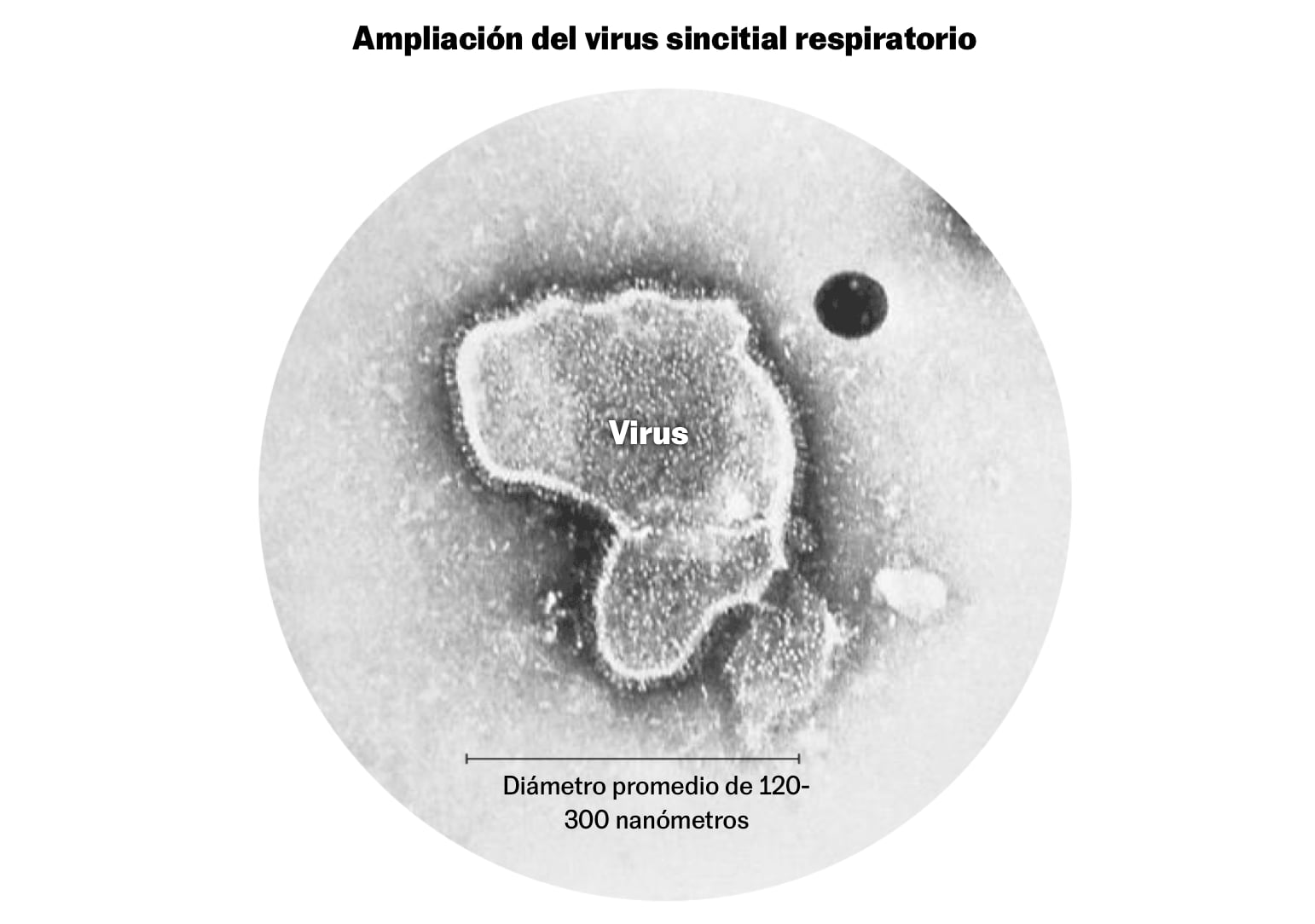 Imagen del virus respiratorio sincitial humano (VRS) donde se aprecia su forma. Fuente: Biblioteca de salud pública del CDC