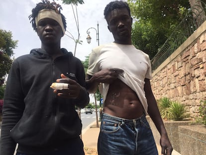 Los jóvenes sudaneses Adam Ali (a la izquierda) y Abdo Abkar muestran sus heridas sufridas durante el intento de salto a la valla de Melilla.