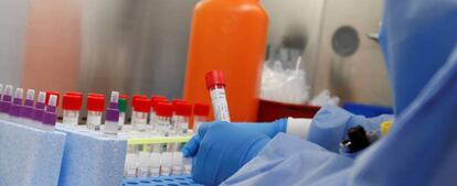 Test de detección del coronavirus.