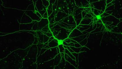 Neuronas en cultivo en el Instituto de Neurociencias español.