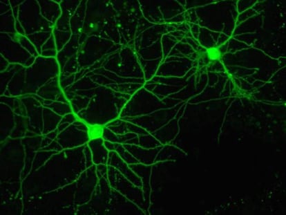 Neuronas en cultivo en el Instituto de Neurociencias español.