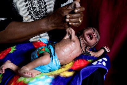 La curandero tradicional, Bi Mwanahija Mzee, sostiene al paciente Mundhir Nasoor, de cuatro semanas de edad, en Zanzíbar, en enero de 2019. El bebé fue llevado porque no quería alimentarse. Ella le diagnosticó que una ingesta de hierro demasiado alta durante la gestación como la razón principal de la enfermedad.