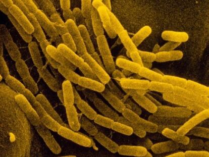 La bacteria 'bacillus cereus', una de las implicadas en la transferencia genética.