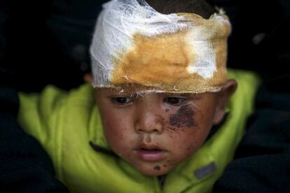 Un niño herido en el terremoto de Nepal