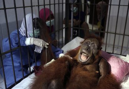 Veterinarios y voluntarios del Programa de Conservación del Orangután de Sumatra asisten a una orangután, a quien llamaron Hope, después de tratar infecciones en algunas partes del cuerpo y reparar huesos rotos, en las instalaciones de Sibolangit, Sumatra del Norte, Indonesia.