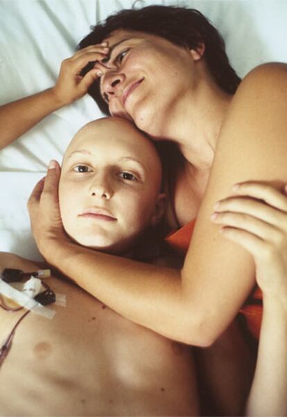 Hugo tenía 12 años cuando le diagnosticaron un cáncer.