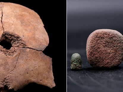 A la izquierda, el cráneo del niño con el orificio de una bala. A la derecha bala, goma de borraz y restos de un lápiz.