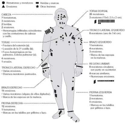 Autopsia al cadáver de Juan Martínez Galdeano.