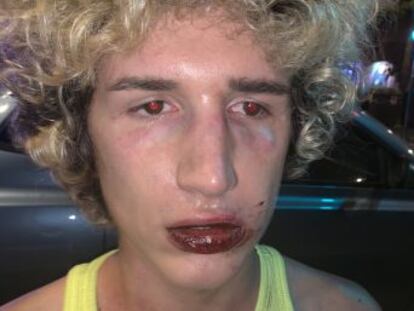 Un joven italiano fue increpado y golpeado de madrugada a la salida de una discoteca, como recoge un vídeo compartido en las redes sociales