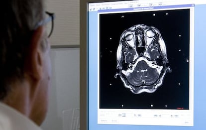 Un especialista examina un escáner cerebral.