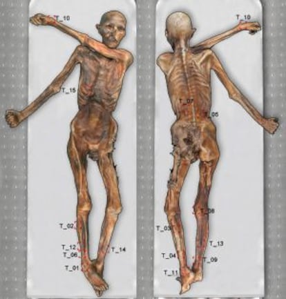 Mapa dels tatuatges de l'home de gel, Ötzi, fet per EURAC.