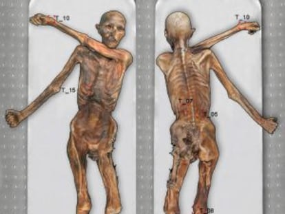 Mapa dels tatuatges de l'home de gel, Ötzi, fet per EURAC.