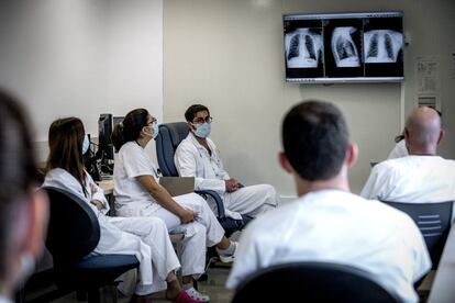 La radiografía de tórax de un paciente preside la sesión clínica de un grupo de médicos del Trueta. Sobre la pantalla de luz, unos pulmones con amenaza de neumonía bilateral, santo y seña de la covid-19, asoman tras las costillas. La historia se repite una y otra vez. Sin cesar. Ahora mismo hay 86 personas ingresadas con covid-19 en el hospital, una treintena de ellas en cuidados intensivos (UCI).