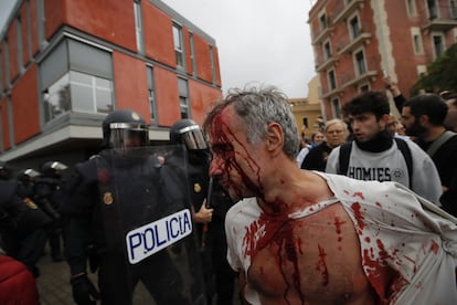 Un hombre herido tras la intervención de la Policía Nacional en la Escuela Mediterránea de Barcelona, en la jornada del referéndum ilegal sobre la independencia de Cataluña, el pasado 1 de octubre.