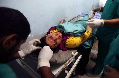 Una mujer es atendida en un hospital cerca de Gaza tras el bombardeo del ejército israelí, el 8 de julio de 2014.