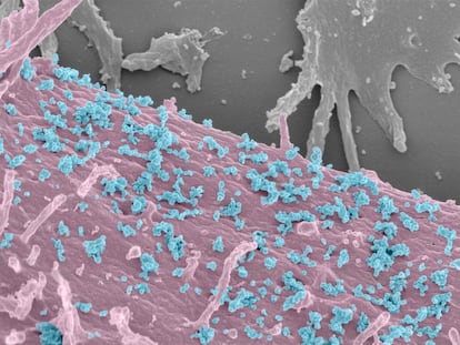 Una célula humana (rosa) libera exosomas (azules), en una imagen tomada con un microscopio electrónico de barrido.