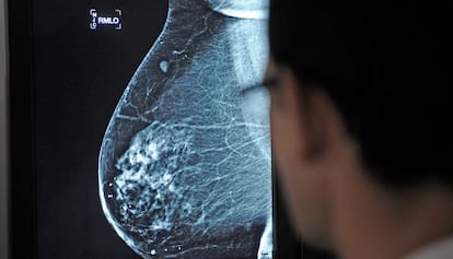 Un médico observa una mamografía en el hospital Virgen del Rocío de Sevilla.