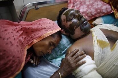 Momtaj se recuesta junto a su hijo Mahbub, un conductor de autob&uacute;s, que se recupera en el hospital de Dacca (Bangladesh) de las quemaduras que sufri&oacute; a ra&iacute;z de que unos manifestantes incendiaran su autob&uacute;s el pasado jueves en una protesta encabezada por el BNP (Partido Nacionalista de Bangladesh).