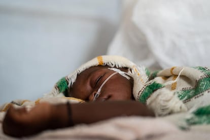 Un niño con complicaciones respiratorias en el Chad, África, a mediados de abril de 2020.