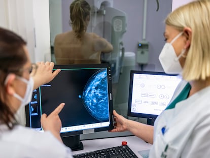 Two health workers review a woman's mammogram.